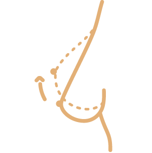 Brustimplantate