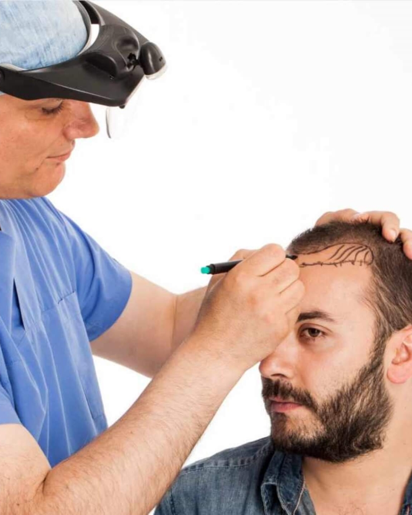 hair transplant package